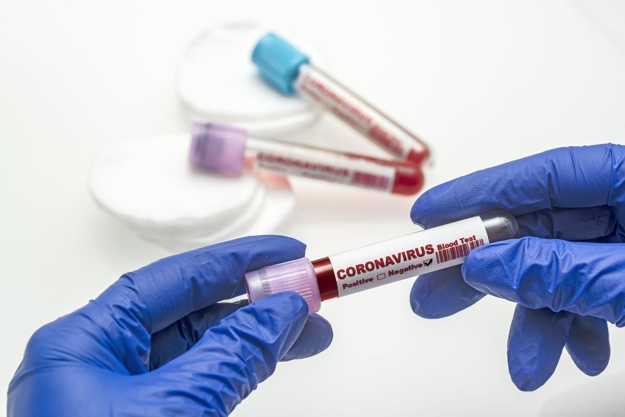 Coronavirus blood test